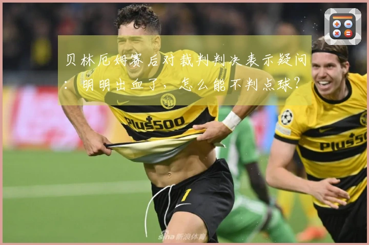 贝林厄姆赛后对裁判判决表示疑问：明明出血了，怎么能不判点球？